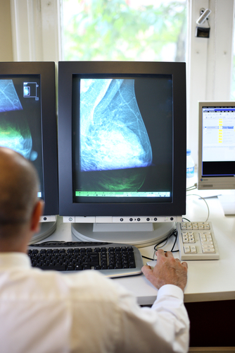 Screening cancro al seno, l’intelligenza artificiale non basta per fare a meno del medico